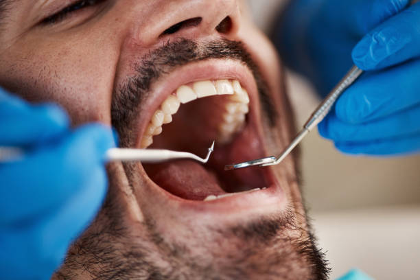 Best Pediatric Emergency Dentist in Summit, IL